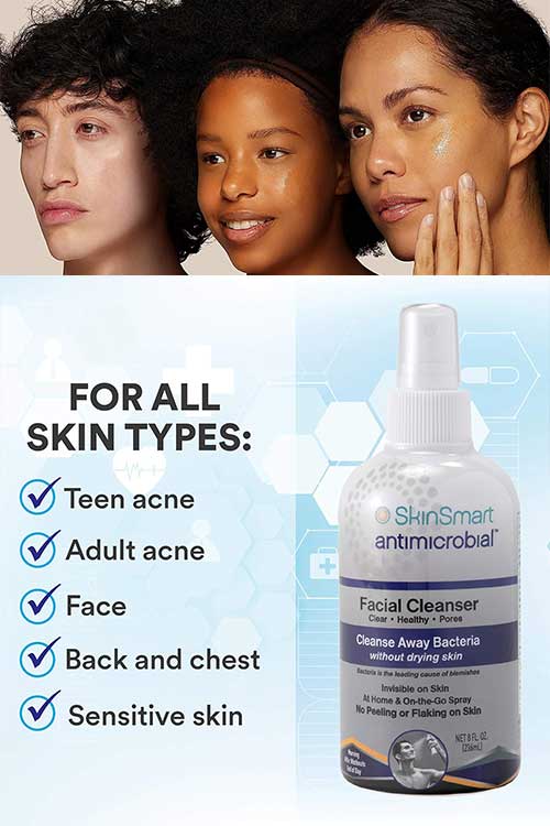 SkinSmart Facial Cleanser for Acne, Targets Bacteria for Active Teenage Athletes post-workout and Adult Acne